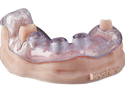 Dental Guides Dental 3D Printing